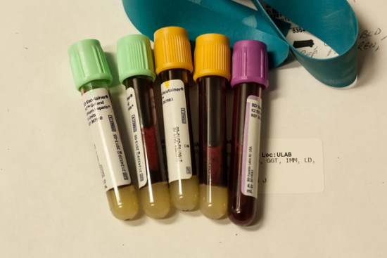 bloedtest